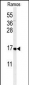 CMTM7 Antibody (N-term)